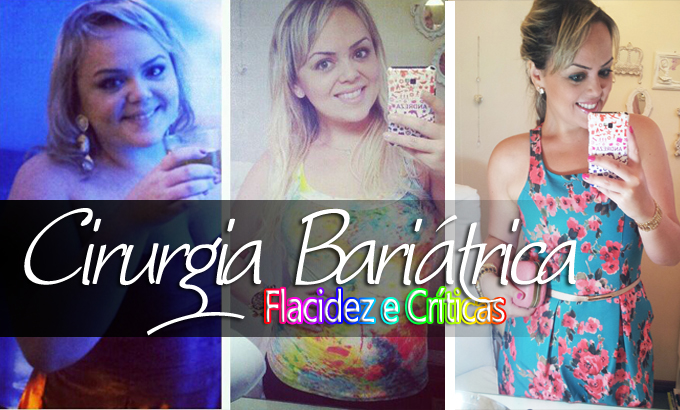Cronograma Capilar para quem fez bariátrica - Blog Andreza Goulart
